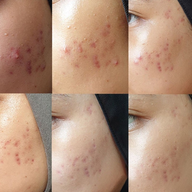 سرم ضدلک و روشن کننده اکسیس وای AXIS Y